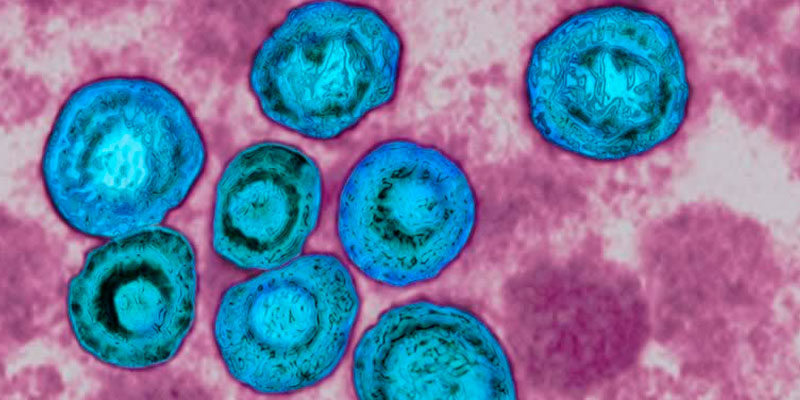Zytomegalieinfektion
