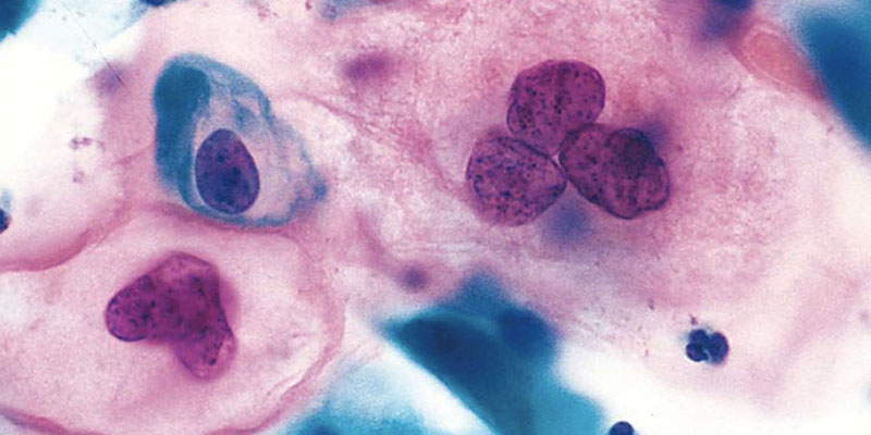 Analyse des Endometriums Bahnstadt Heidelberg