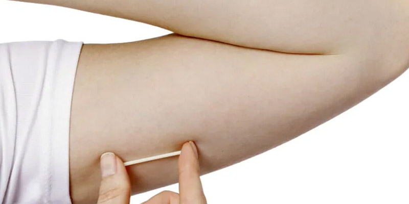 Das Hormonimplantat -Gynäkologische Vorsorgeuntersuchungen Heidelberg BahnstadtFrauenarzt Dr. Blumenstein