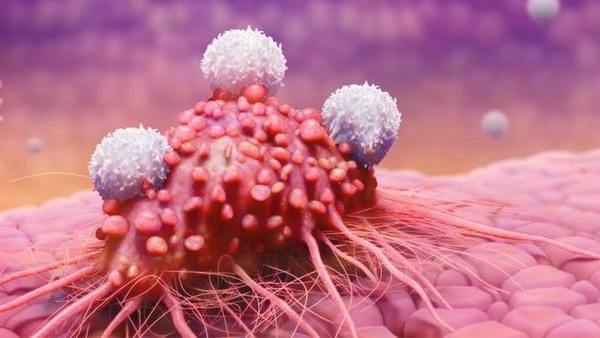 Gebärmutterkrebs oder Endometriumkarzinom Gebärmutterkrebs oder Endometriumkarzinom
