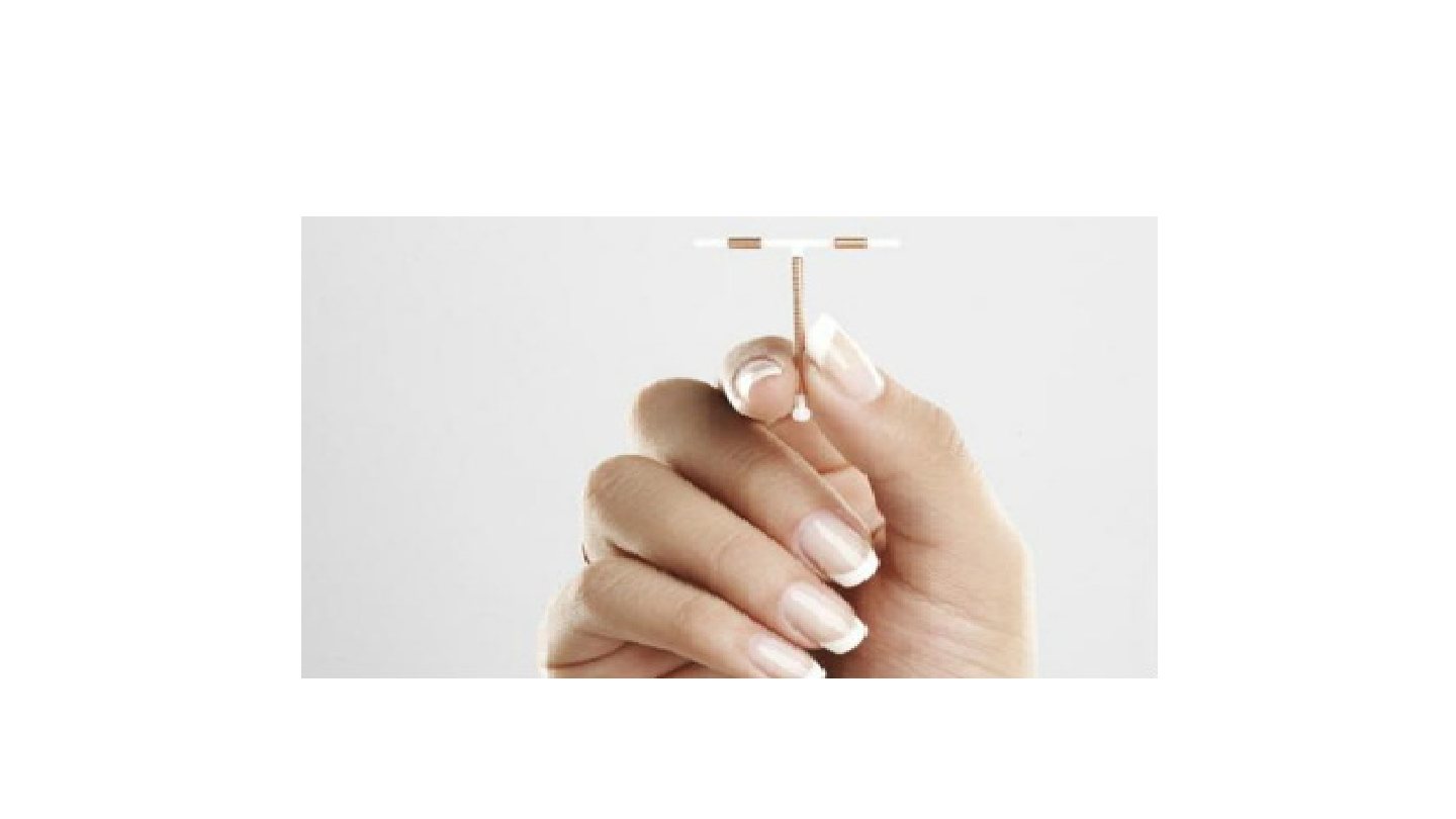 IUD in Narkose Dr Blumenstein Spiraleneinlage in Narkose